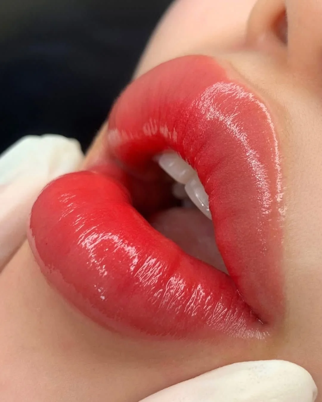 Lip blush result